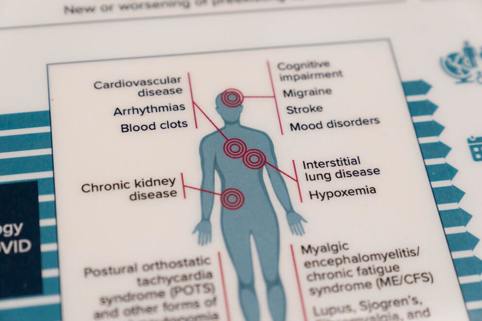 A diagram of an body shows symptoms of COVID 